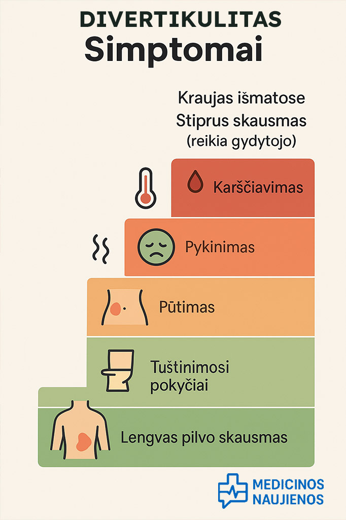 divertikulito simptomai