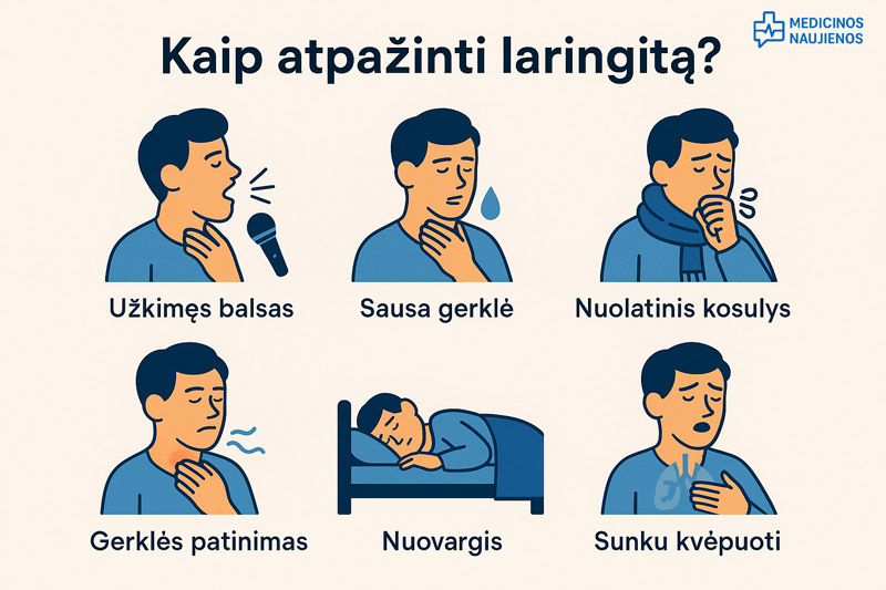 laringitas simptomai