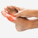 % Podagra: Simptomai, priežastys, gydymas