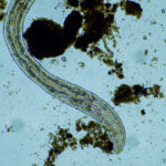 % Kaspinuočių infekcija: simptomai, prevencija, gydymas