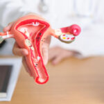 % Adenomioze: simptomai, priežastys, gydymas, prevencija