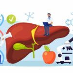 % Kepenų cirozė: Simptomai, priežastys, gydymas