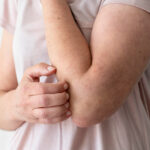 % Celiakija: Simptomai, priežastys, gydymas, prevencija