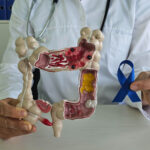 % Žarnyno nelaikymas: Simptomai, priežastys, gydymas, prevencija