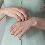 % Diuringo pūslelinis dermatitas: Simptomai, priežastys, gydymas, prevencija