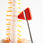 % Juosmens srities stenozė: Simptomai, priežastys, gydymas, prevencija