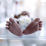 % Staigios kūdikių mirties sindromas (SIDS): simptomai, priežastys, gydymas, prevencija