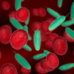 % Sepsis: simptomai, priežastys, gydymas, prevencija