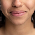 % Burnos vėžys: Simptomai, priežastys, gydymas, prevencija