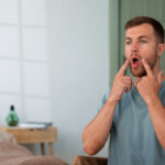 % Burnos opa: Simptomai, priežastys, gydymas, prevencija