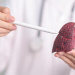 % Kepenų navikai: Simptomai, priežastys, gydymas, prevencija