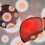 % Hepatitas A: simptomai, priežastys, gydymas, prevencija