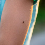 % Gaktos utėlės: Simptomai, priežastys, gydymas, prevencija