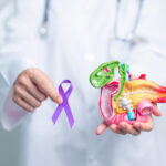 % Kasos vėžys: Simptomai, priežastys, gydymas, prevencija