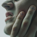 % Rankų, kojų ir burnos liga: simptomai, priežastys, gydymas, prevencija