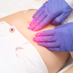 % Gimdos mioma: Simptomai, priežastys, gydymas, prevencija