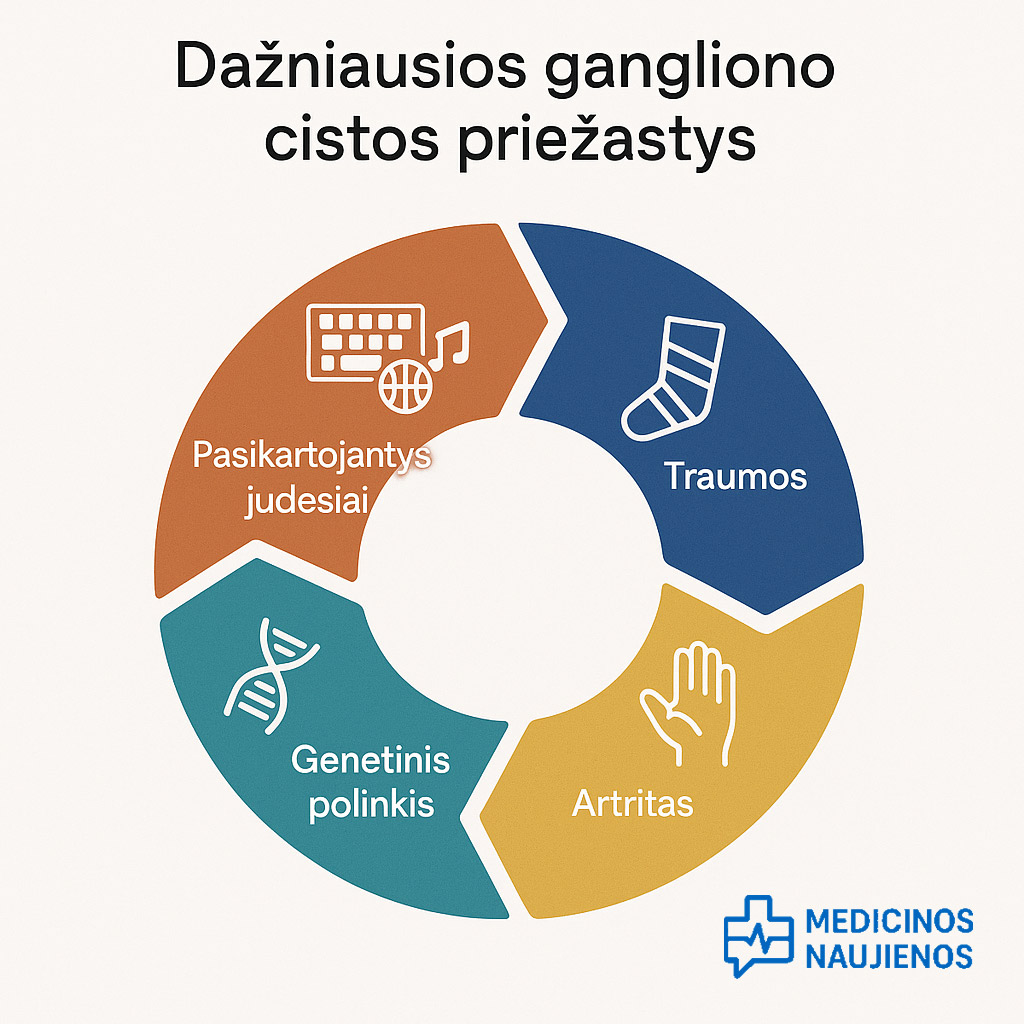 Gangliono cistos priezastys