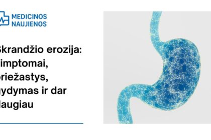 % Skrandžio erozija: simptomai, priežastys, gydymas ir dar daugiau