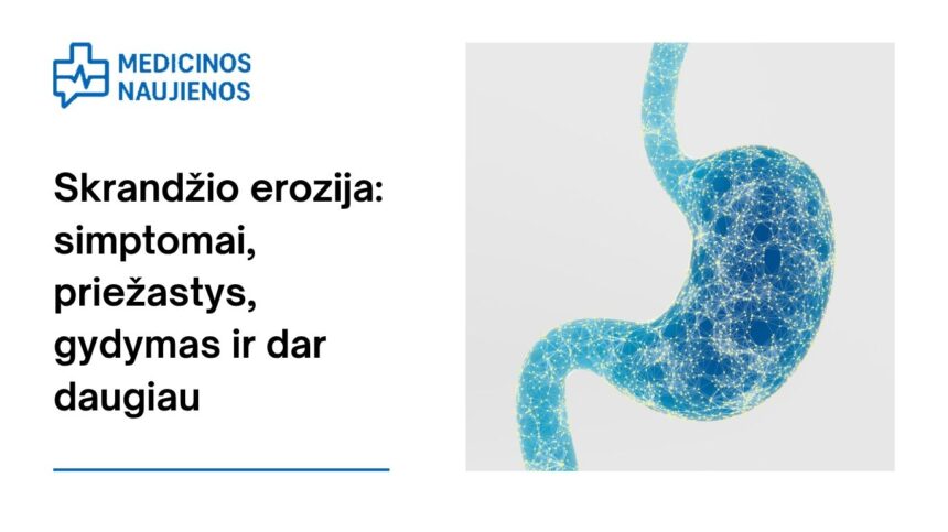 % Skrandžio erozija: simptomai, priežastys, gydymas ir dar daugiau
