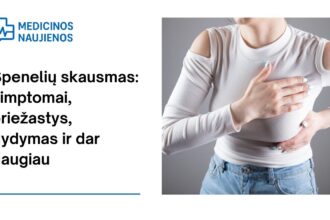 % Spenelių skausmas: simptomai, priežastys, gydymas ir dar daugiau