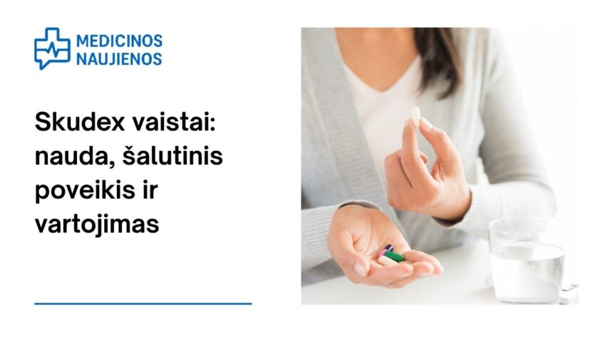 % Skudex: galimas šalutinis poveikis, kaip vartoti ir dar daugiau