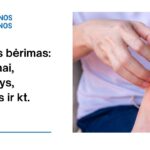 % Alerginis bėrimas: simptomai, priežastys, gydymas ir kt.