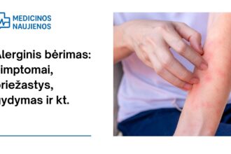 % Alerginis bėrimas: simptomai, priežastys, gydymas ir kt.