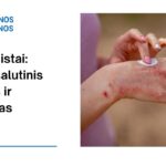 % Elidel: nauda, galimas šalutinis poveikis, kaip vartoti ir dar daugiau