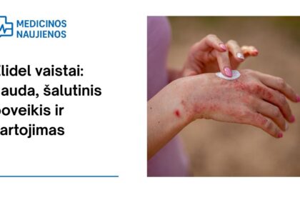 % Elidel: nauda, galimas šalutinis poveikis, kaip vartoti ir dar daugiau