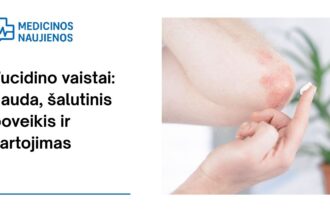 % Fucidin tepalas: nauda, galimas šalutinis poveikis, kaip vartoti ir dar daugiau
