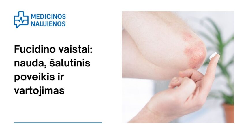 % Fucidin tepalas: nauda, galimas šalutinis poveikis, kaip vartoti ir dar daugiau