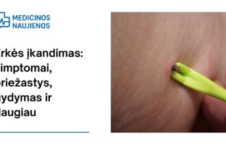 % Erkės įkandimas: simptomai, priežastys, gydymas ir daugiau