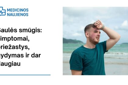% Saulės smūgis: simptomai, priežastys, gydymas ir dar daugiau