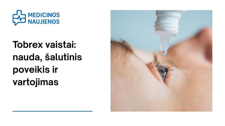 % Tobrex: kuo jis gali padėti, galimas šalutinis poveikis, kaip vartoti ir dar daugiau