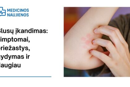 % Blusų įkandimas: simptomai, priežastys, gydymas ir daugiau