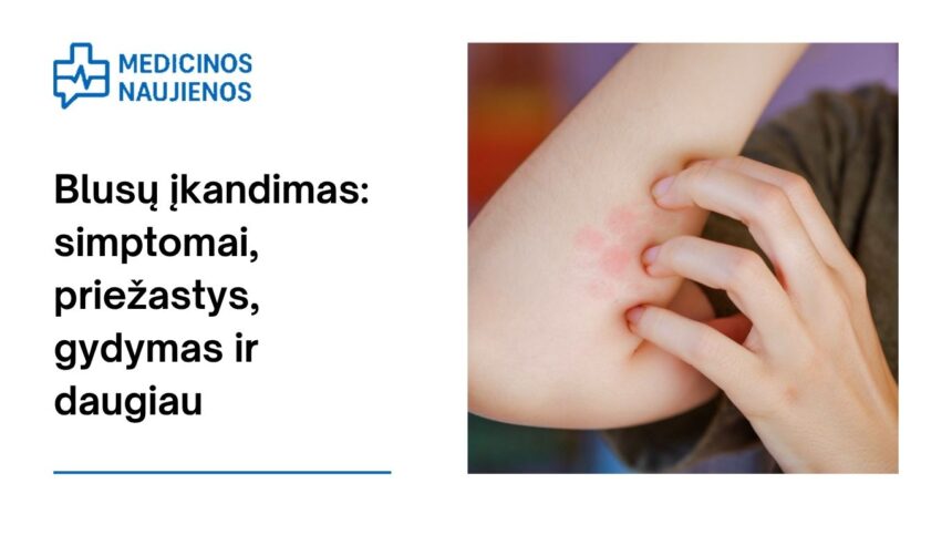% Blusų įkandimas: simptomai, priežastys, gydymas ir daugiau