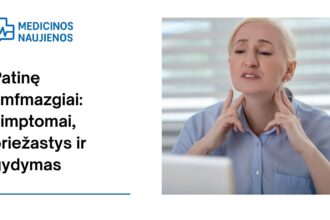 % Padidėję limfmazgiai: simptomai, priežastys, gydymas ir kt.