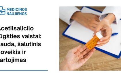 % Acetilsalicilo rūgštis: kuo gali padėti, galimas šalutinis poveikis, kaip vartoti ir dar daugiau