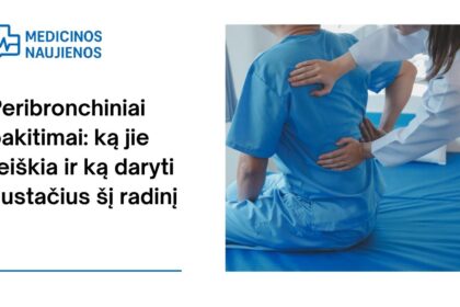 % Peribronchiniai pakitimai: ką jie reiškia ir ką daryti nustačius šį radinį