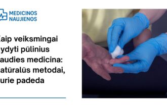 % Kaip veiksmingai gydyti pūlinius liaudies medicina: natūralūs metodai, kurie padeda