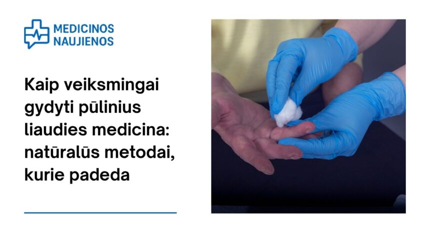 % Kaip veiksmingai gydyti pūlinius liaudies medicina: natūralūs metodai, kurie padeda