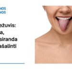 % Baltas liežuvis: ką reiškia, kodėl atsiranda ir kaip pašalinti