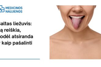 % Baltas liežuvis: ką reiškia, kodėl atsiranda ir kaip pašalinti