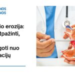 % Skrandžio erozija: kaip ją atpažinti, gydyti ir apsisaugoti nuo komplikacijų