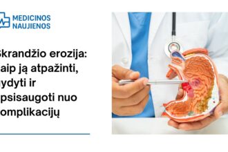 % Skrandžio erozija: kaip ją atpažinti, gydyti ir apsisaugoti nuo komplikacijų