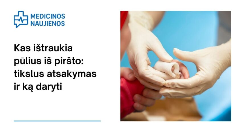 % Kas ištraukia pūlius iš piršto: tikslus atsakymas ir ką daryti