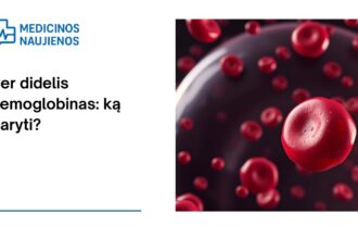 % Per didelis hemoglobinas: ką daryti?