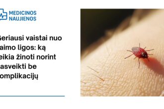 % Geriausi vaistai nuo Laimo ligos: ką reikia žinoti norint pasveikti be komplikacijų