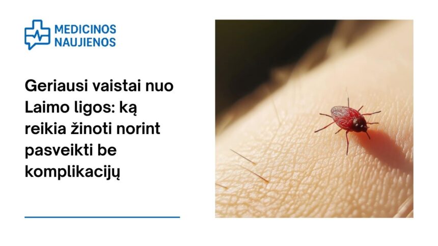 % Geriausi vaistai nuo Laimo ligos: ką reikia žinoti norint pasveikti be komplikacijų