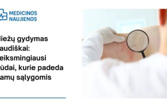 % Niežų gydymas liaudiškai: veiksmingiausi būdai, kurie padeda namų sąlygomis